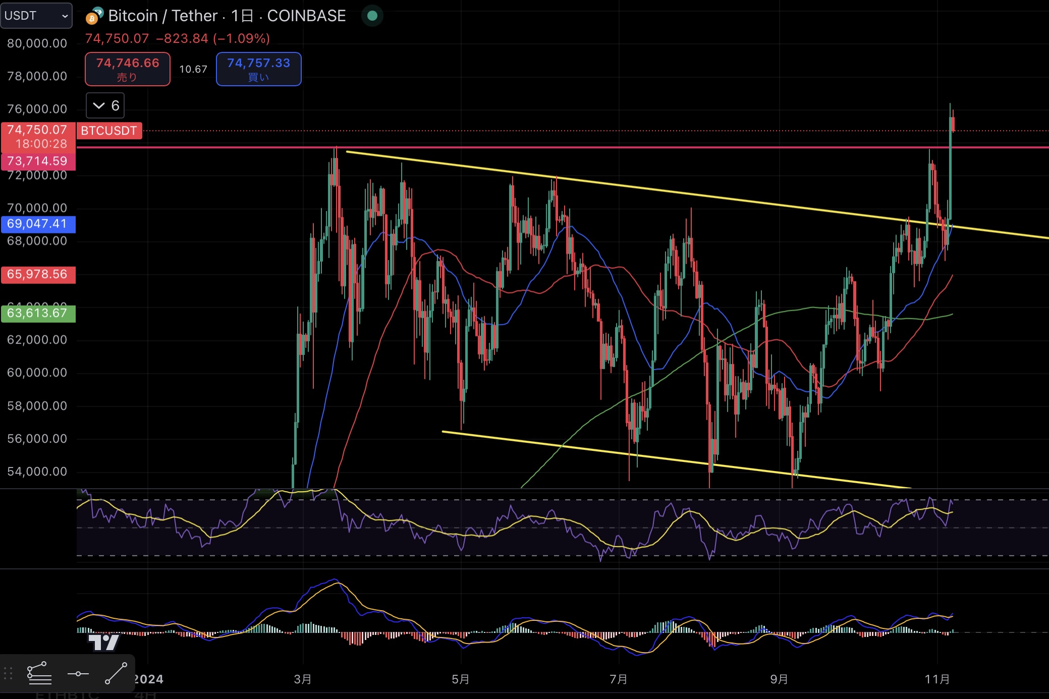 BTCUSDT/1D chart Source:Trading View 