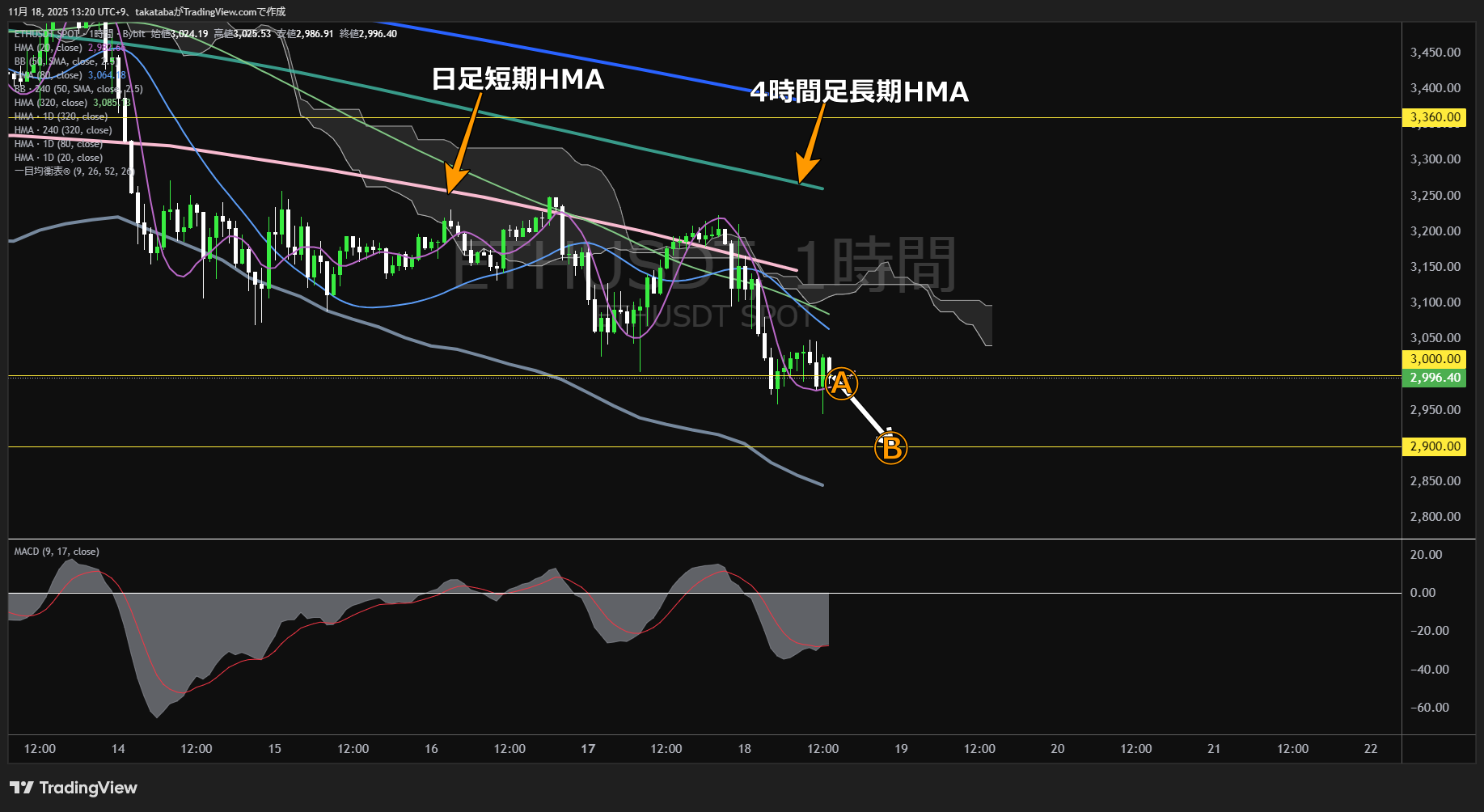 イーサリアム(ETH)-1時間足チャート分析-2025年11月18日