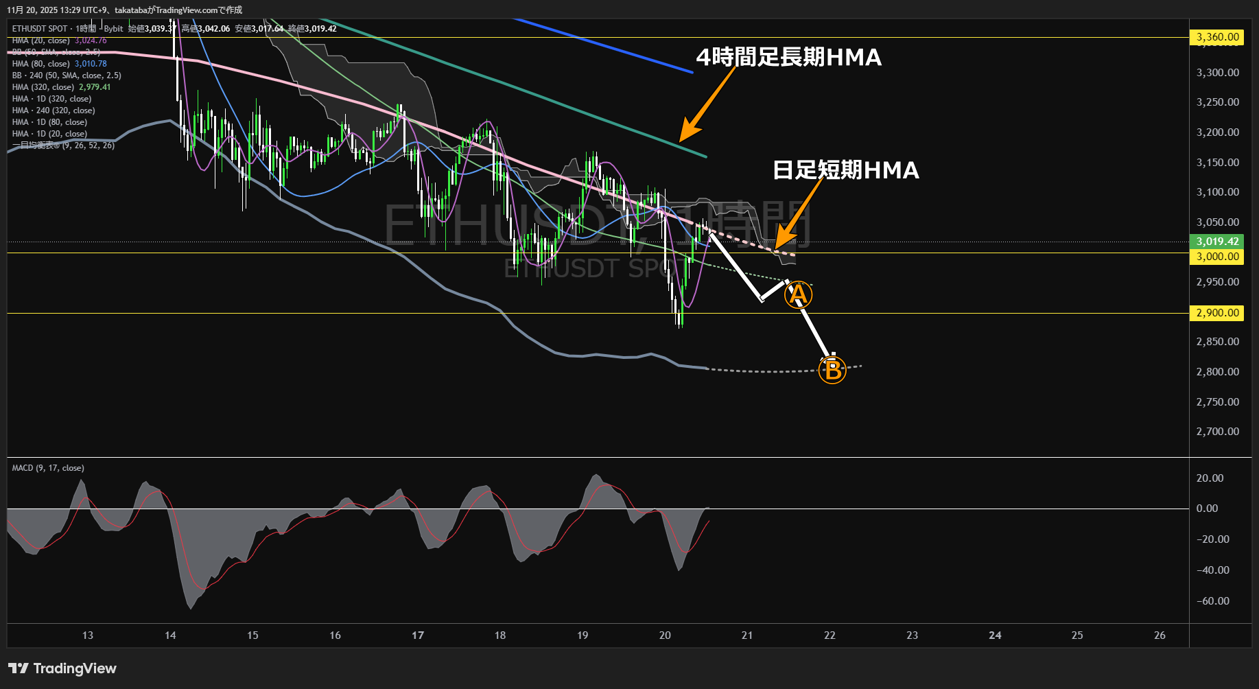 イーサリアム（ETH）-1時間足チャート分析-2025年11月20日