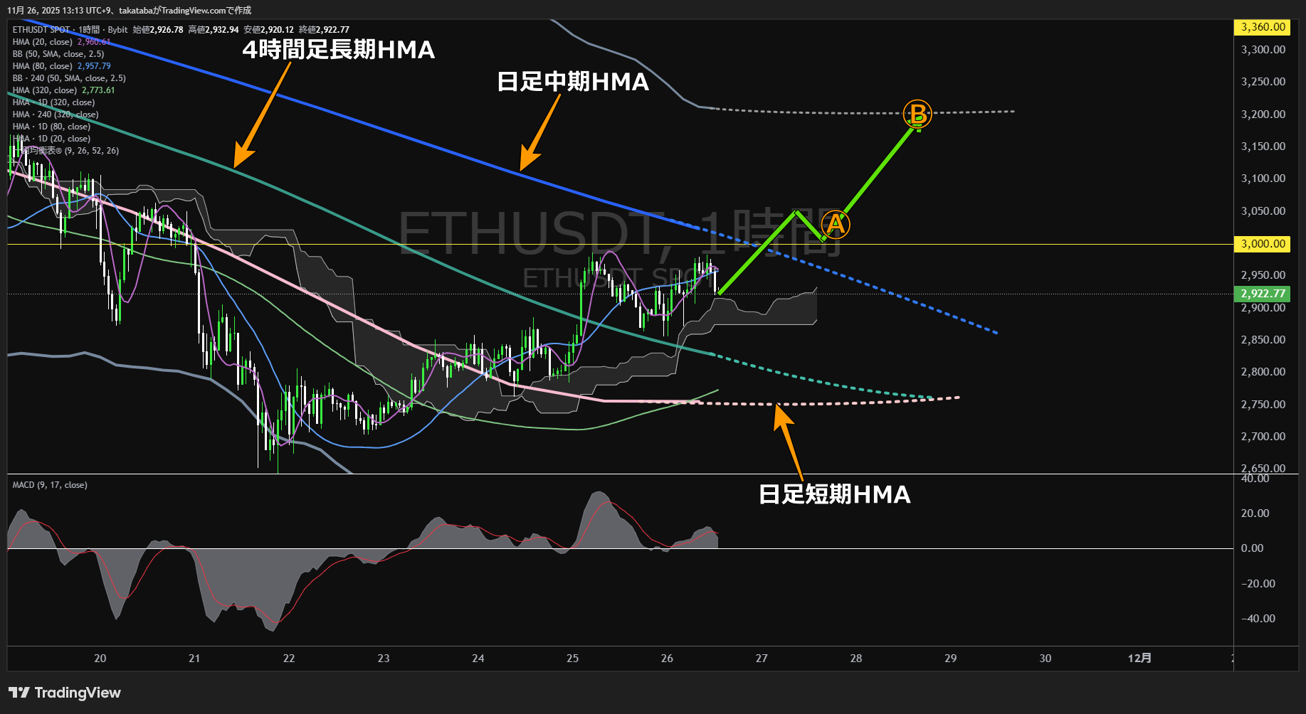 イーサリアム(ETH)-1時間足チャート分析-2025年11月26日