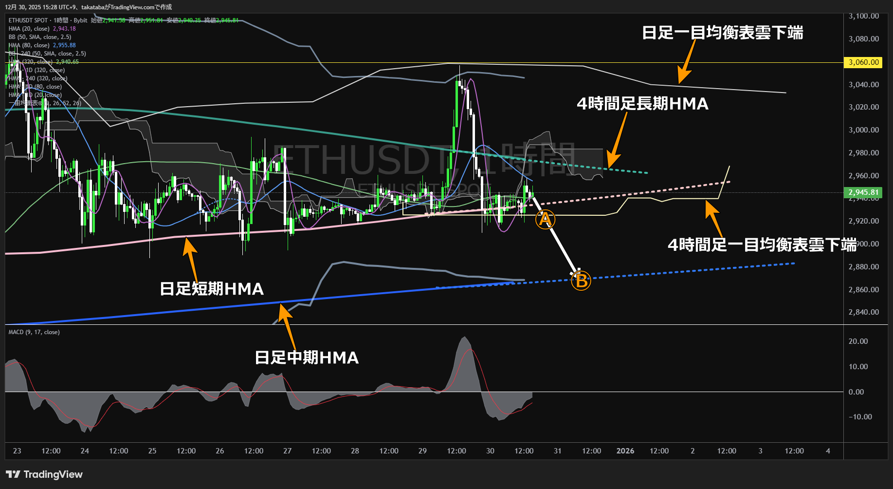 イーサリアム（ETH）-1時間足チャート分析-2025年12月30日